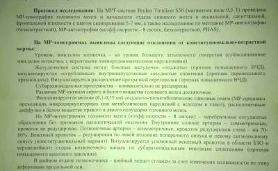 Побочные эффекты антибиотиков глиоз, нарушение памяти МРТ заключение